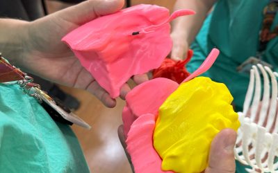 TECNOLOGIA EN SALUD: Equipo de cirujanos del HRRIO extirpan tumor a niña de dos años con apoyo de modelos anatómicos a escala real impresos en 3D