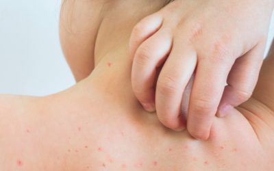 Revista Nature destaca investigación realizada por especialistas de Inmunología y Reumatología del HRRIO